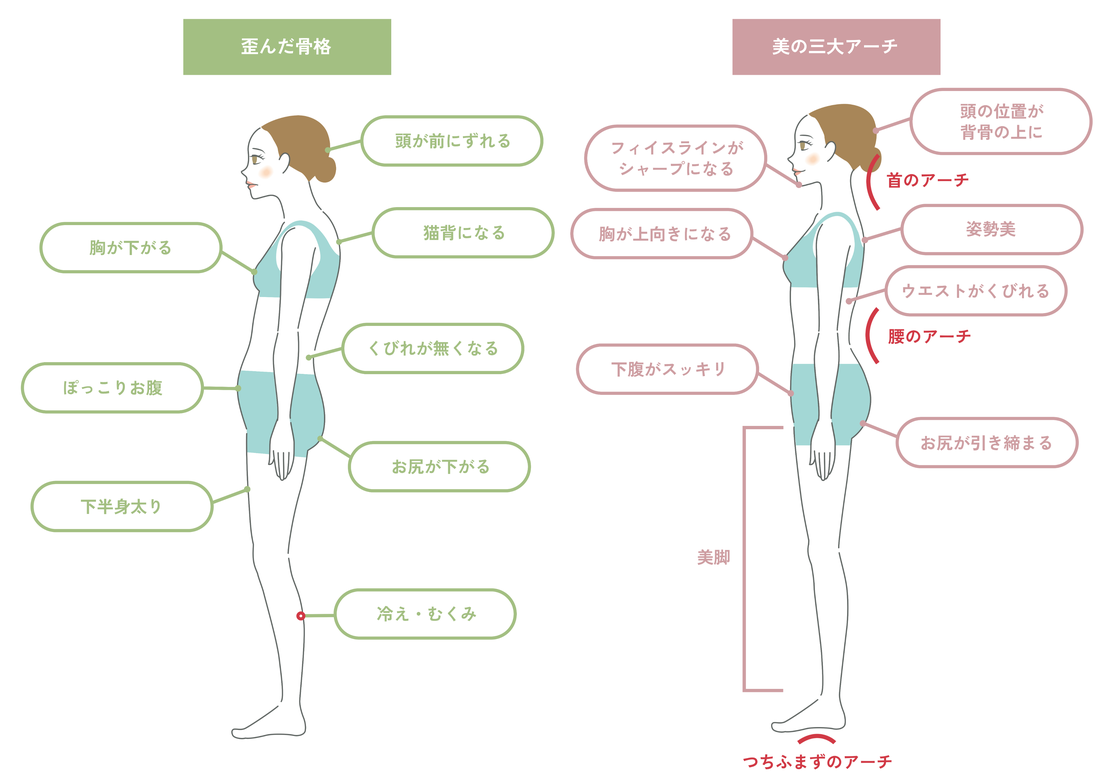 歪んだ骨格と美の三大アーチを比べた図